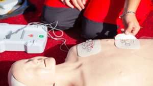 CPR Levels Explained